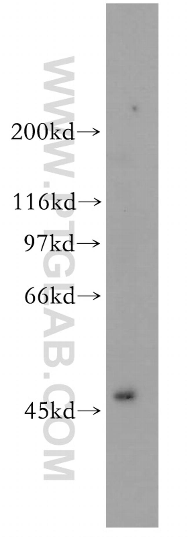 TFAP2A/AP-2 Antibody in Western Blot (WB)