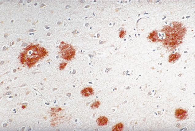 Amyloid Precursor Protein Antibody in Immunohistochemistry (IHC)