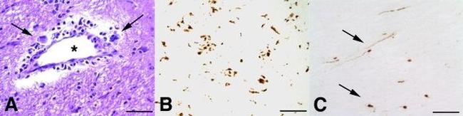 Amyloid Precursor Protein Antibody in Immunohistochemistry (Paraffin) (IHC (P))