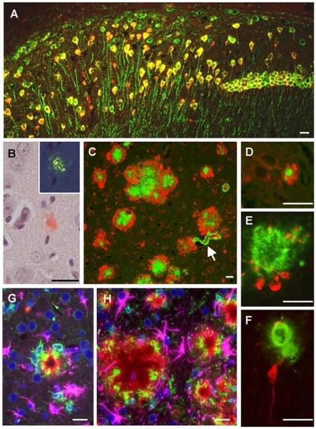 Amyloid Precursor Protein Antibody in Immunocytochemistry (ICC/IF)