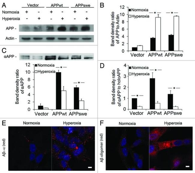 Amyloid Precursor Protein Antibody in Western Blot (WB)