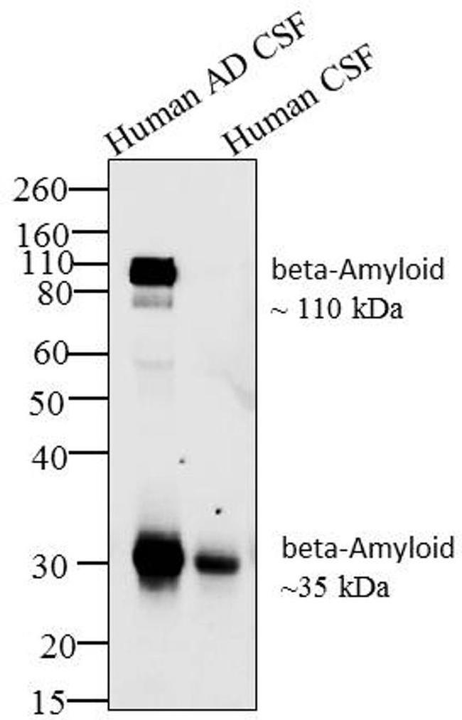 Amyloid Precursor Protein Antibody in Western Blot (WB)