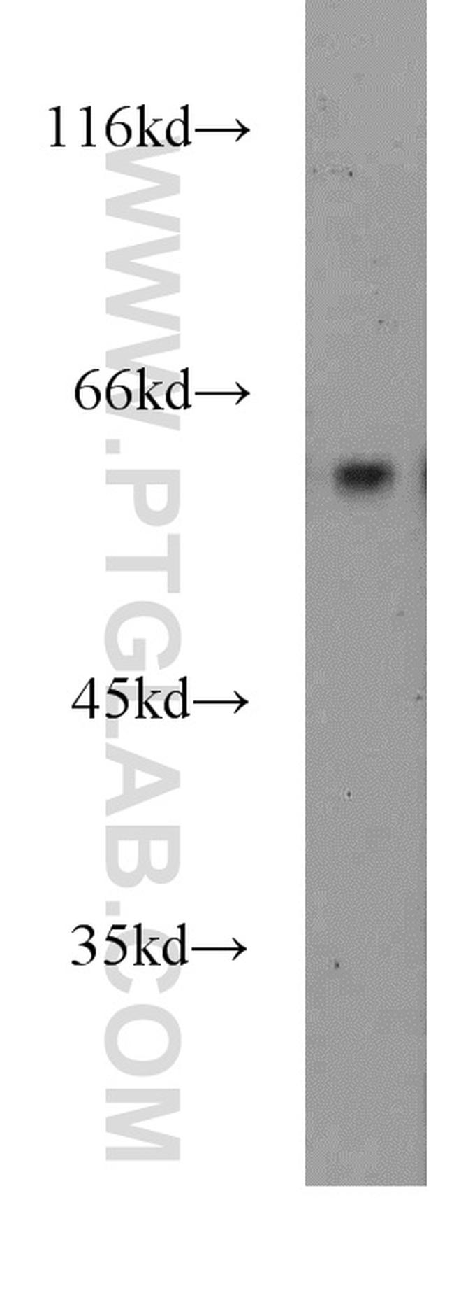 ENTPD3 Antibody in Western Blot (WB)