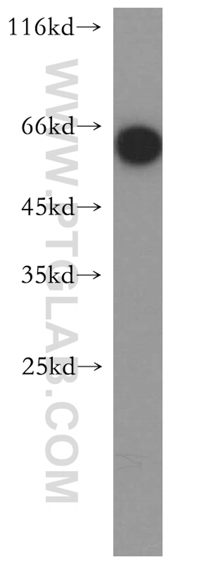 ENTPD3 Antibody in Western Blot (WB)