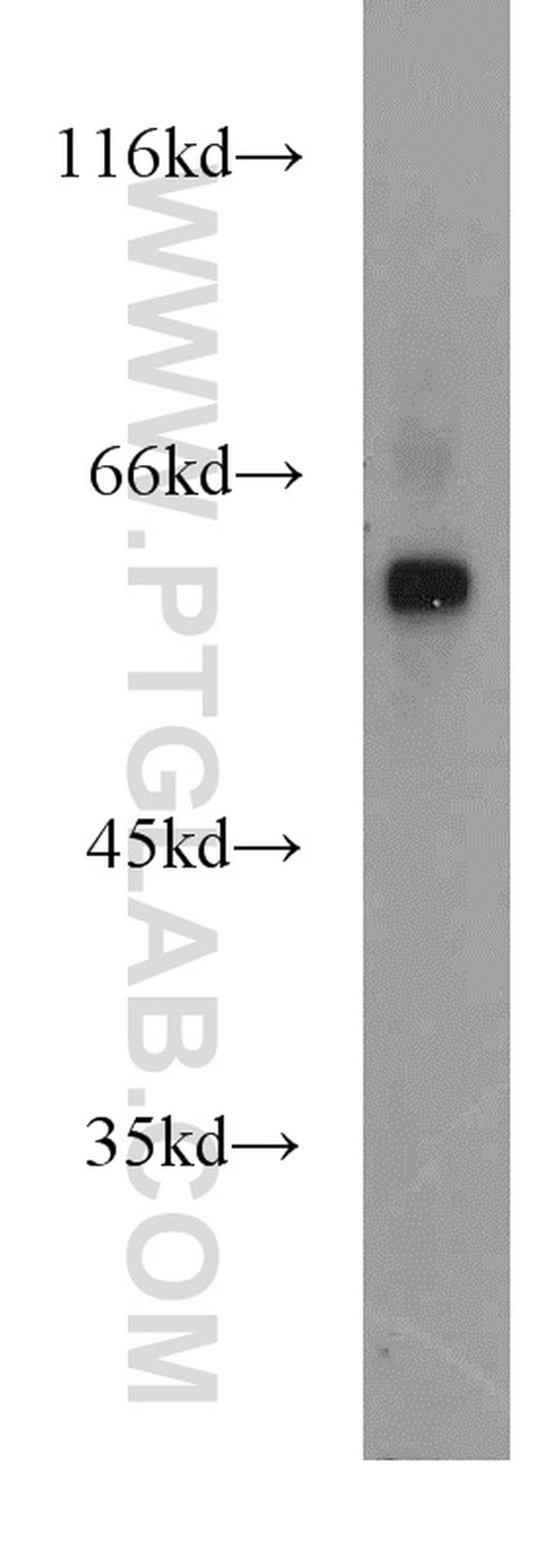 ENTPD3 Antibody in Western Blot (WB)