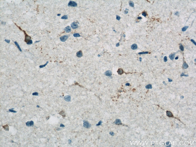 RRAGB Antibody in Immunohistochemistry (Paraffin) (IHC (P))