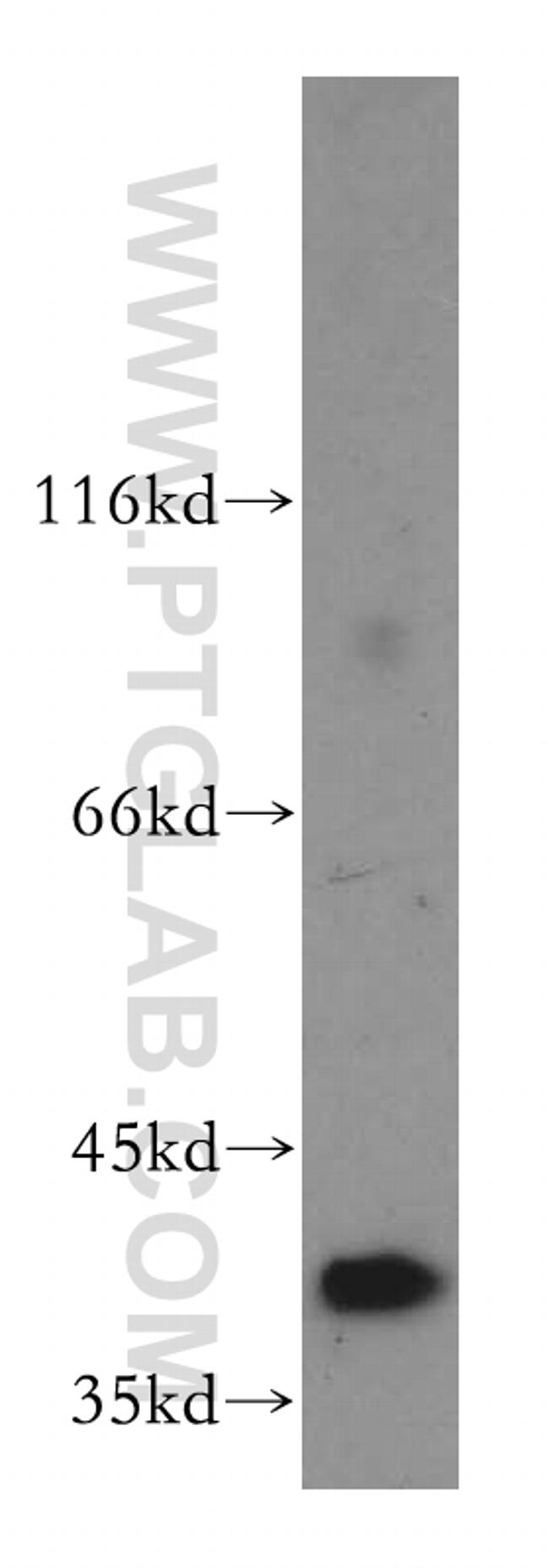 RRAGB Antibody in Western Blot (WB)