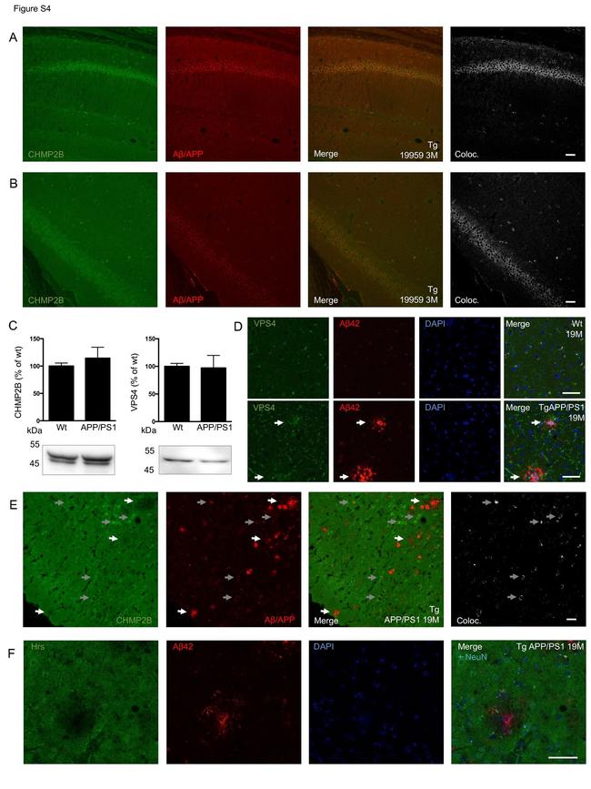 Amyloid Precursor Protein Antibody in Immunocytochemistry (ICC/IF)