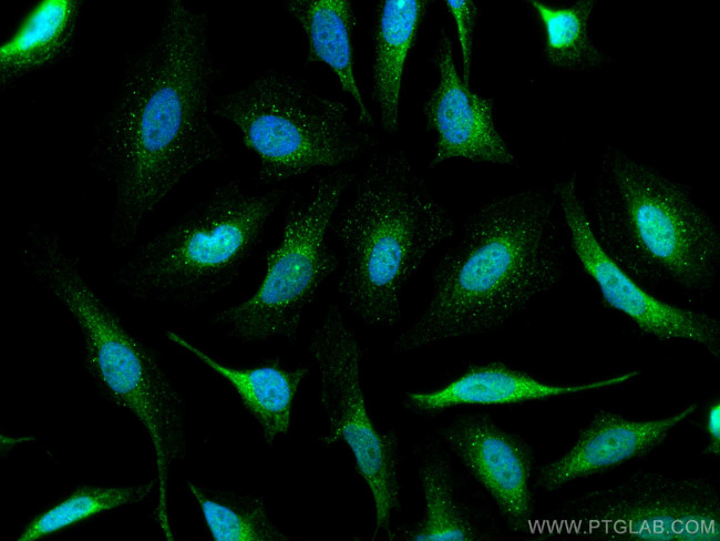 STAT4 Antibody in Immunocytochemistry (ICC/IF)