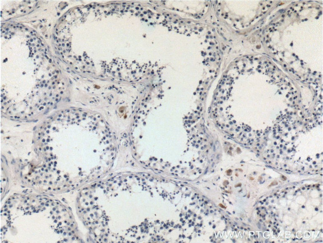 STAT4 Antibody in Immunohistochemistry (Paraffin) (IHC (P))