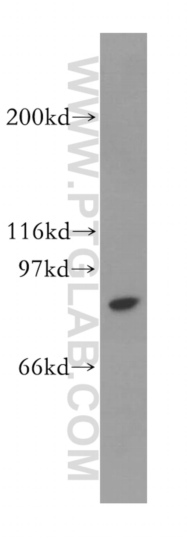 STAT4 Antibody in Western Blot (WB)