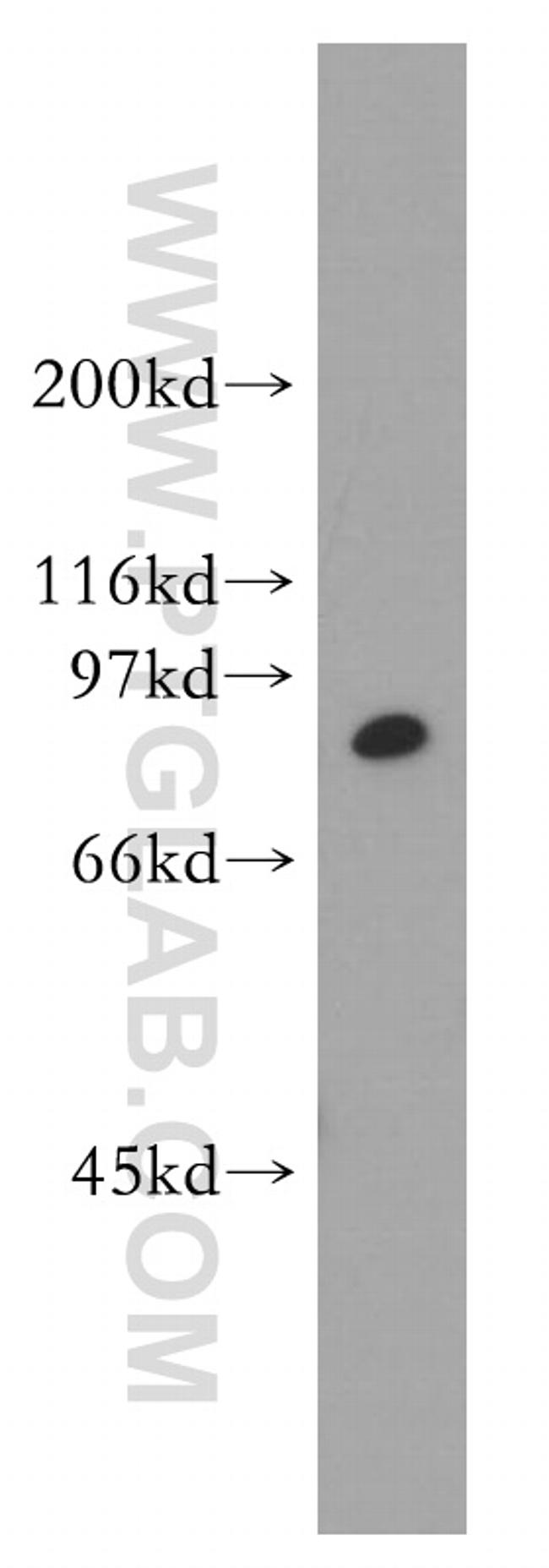 STAT4 Antibody in Western Blot (WB)