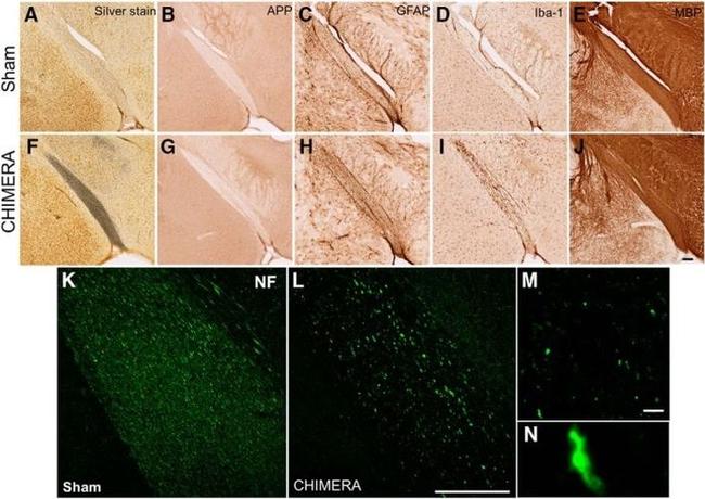 beta Amyloid Antibody in Immunohistochemistry (IHC)