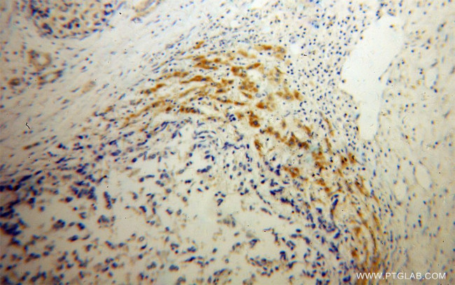 AADAT Antibody in Immunohistochemistry (Paraffin) (IHC (P))