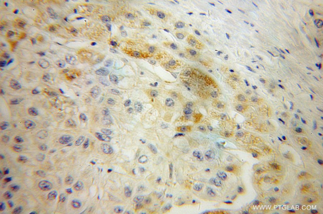 AADAT Antibody in Immunohistochemistry (Paraffin) (IHC (P))