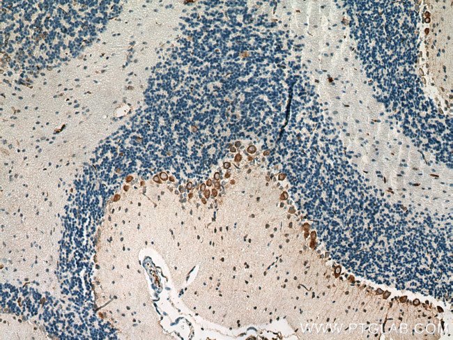 AADAT Antibody in Immunohistochemistry (Paraffin) (IHC (P))