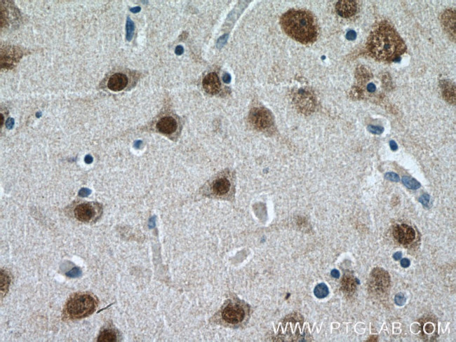 HuA/B/C/D Antibody in Immunohistochemistry (Paraffin) (IHC (P))