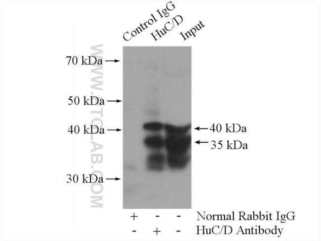 HuA/B/C/D Antibody in Immunoprecipitation (IP)