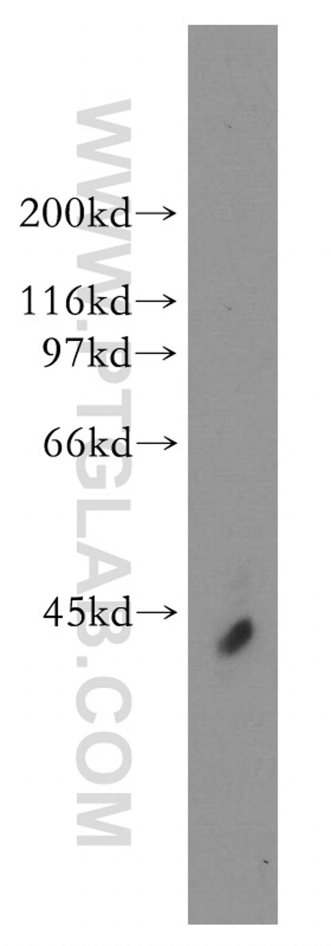 HuA/B/C/D Antibody in Western Blot (WB)