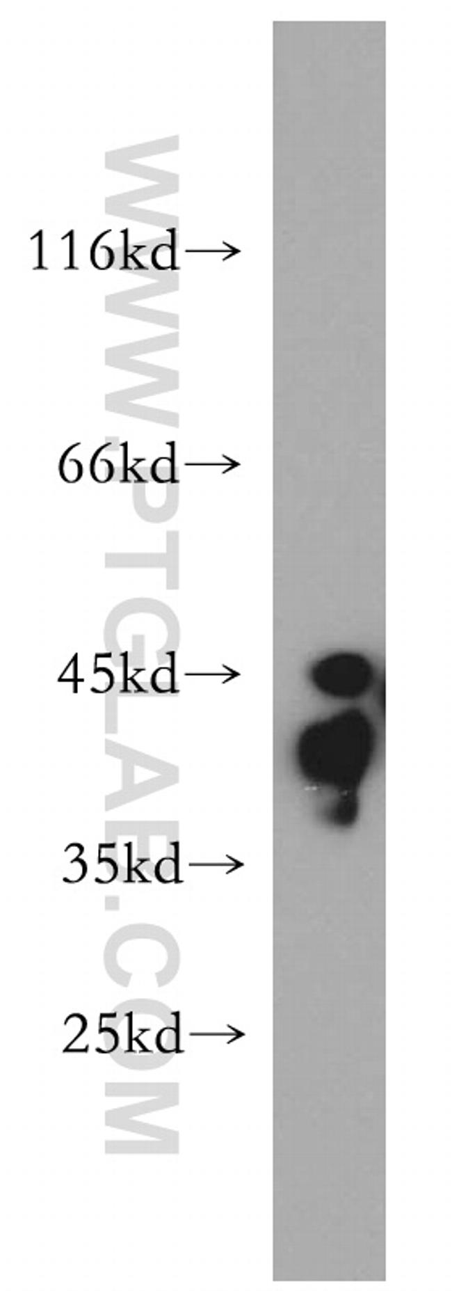 HuA/B/C/D Antibody in Western Blot (WB)