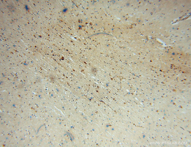 SACM1L Antibody in Immunohistochemistry (Paraffin) (IHC (P))