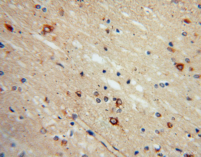 SACM1L Antibody in Immunohistochemistry (Paraffin) (IHC (P))