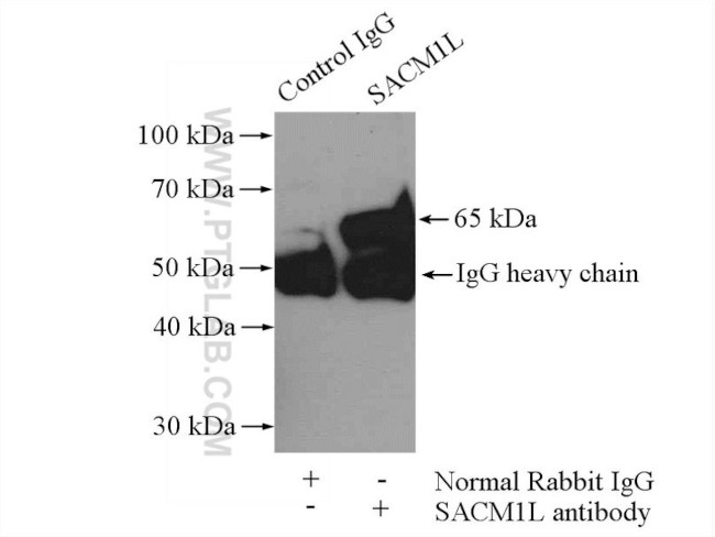 SACM1L Antibody in Immunoprecipitation (IP)