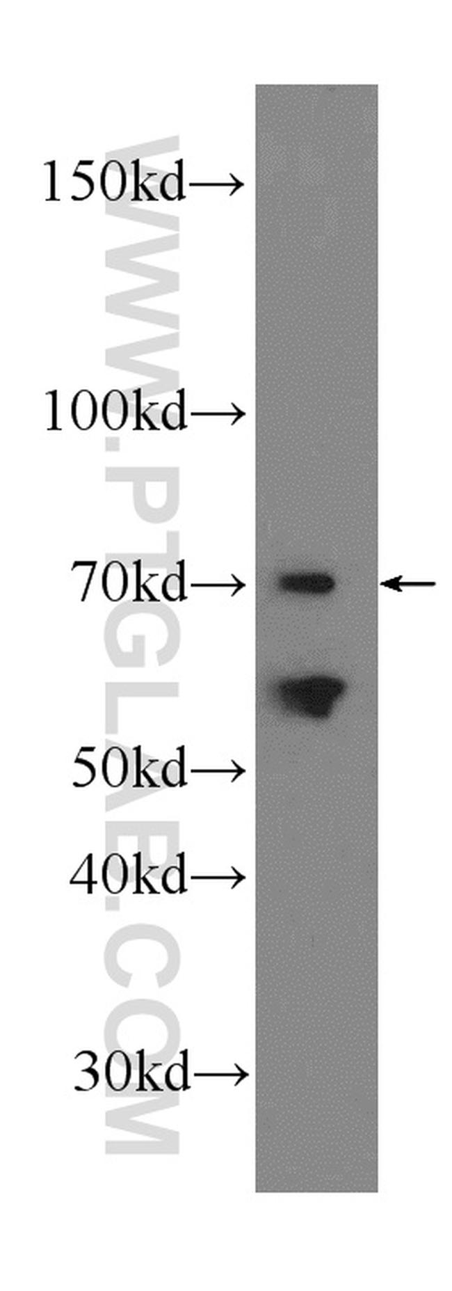 SACM1L Antibody in Western Blot (WB)