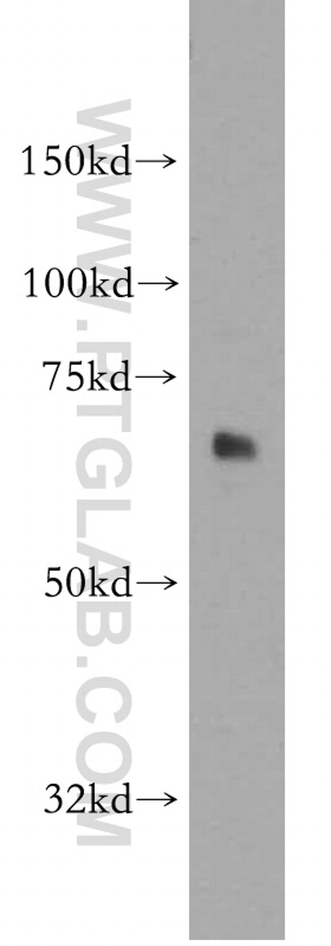 SACM1L Antibody in Western Blot (WB)