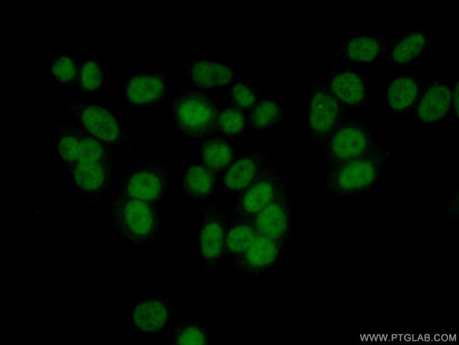 RAD9A Antibody in Immunocytochemistry (ICC/IF)