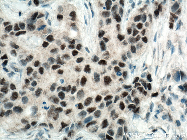 RAD9A Antibody in Immunohistochemistry (Paraffin) (IHC (P))