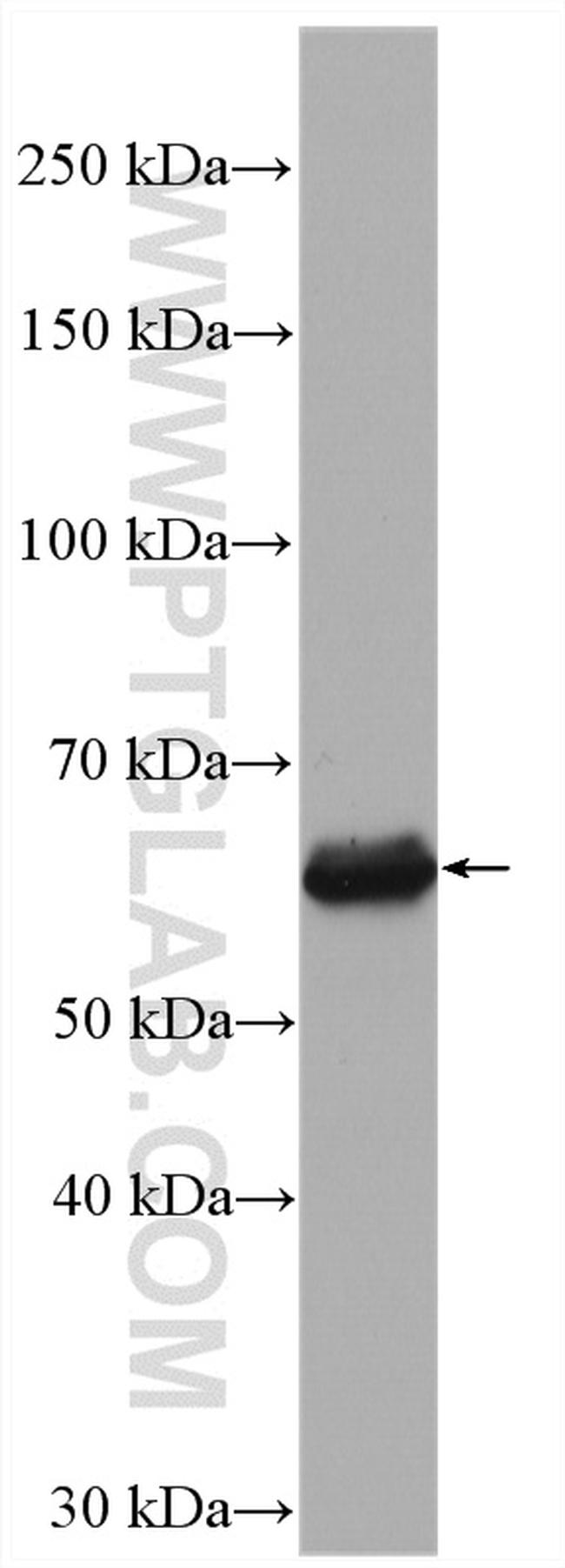 RAD9A Antibody in Western Blot (WB)