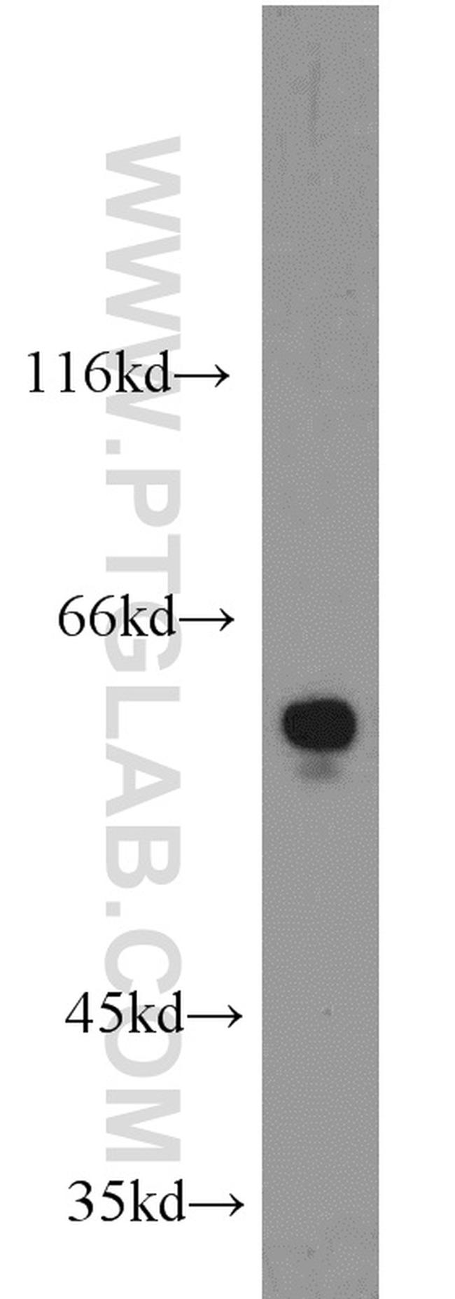 RAD9A Antibody in Western Blot (WB)