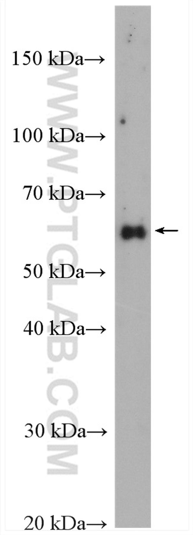 RAD9A Antibody in Western Blot (WB)