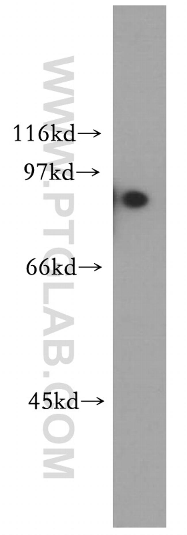 TRIM37 Antibody in Western Blot (WB)