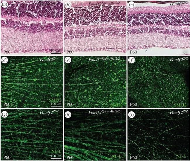 NEFL Antibody in Immunohistochemistry (IHC)