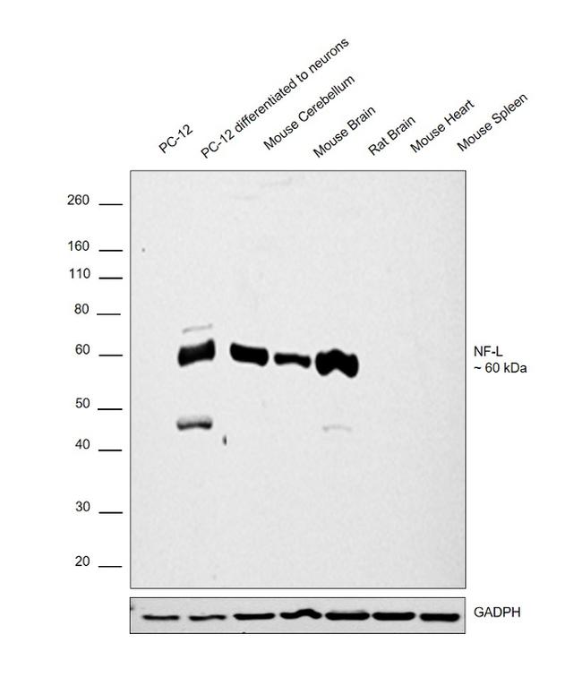 NEFL Antibody in Western Blot (WB)