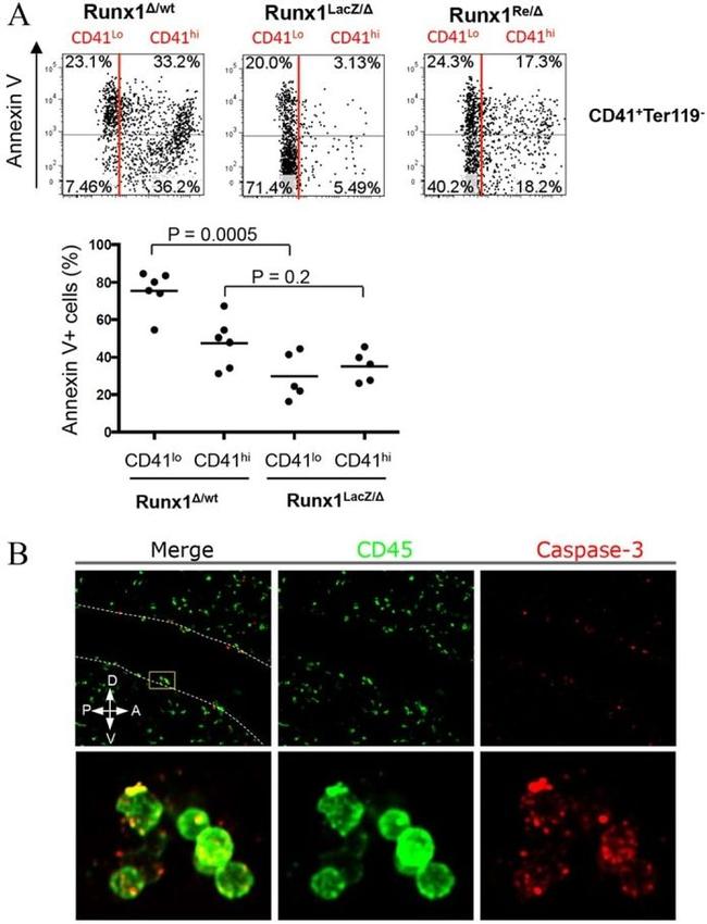 CD41a Antibody in Immunohistochemistry (IHC)