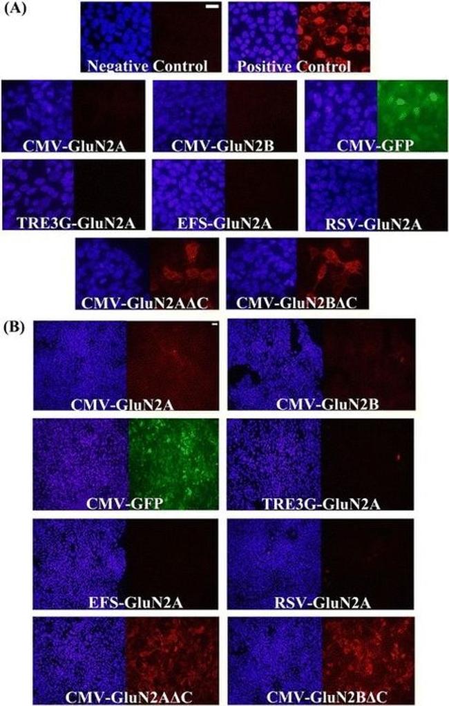 DYKDDDDK Tag Antibody in Immunocytochemistry (ICC/IF)