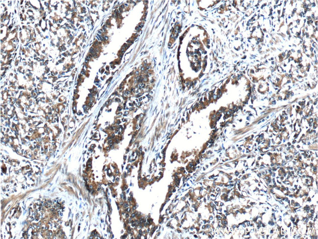 FGFR2 Antibody in Immunohistochemistry (Paraffin) (IHC (P))