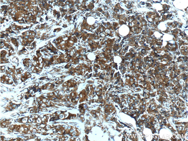 FGFR2 Antibody in Immunohistochemistry (Paraffin) (IHC (P))