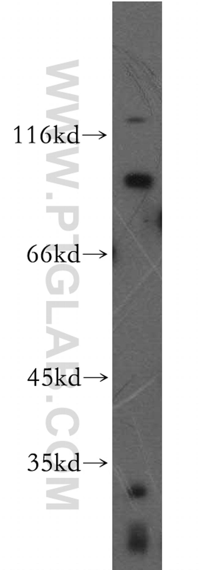 FGFR2 Antibody in Western Blot (WB)