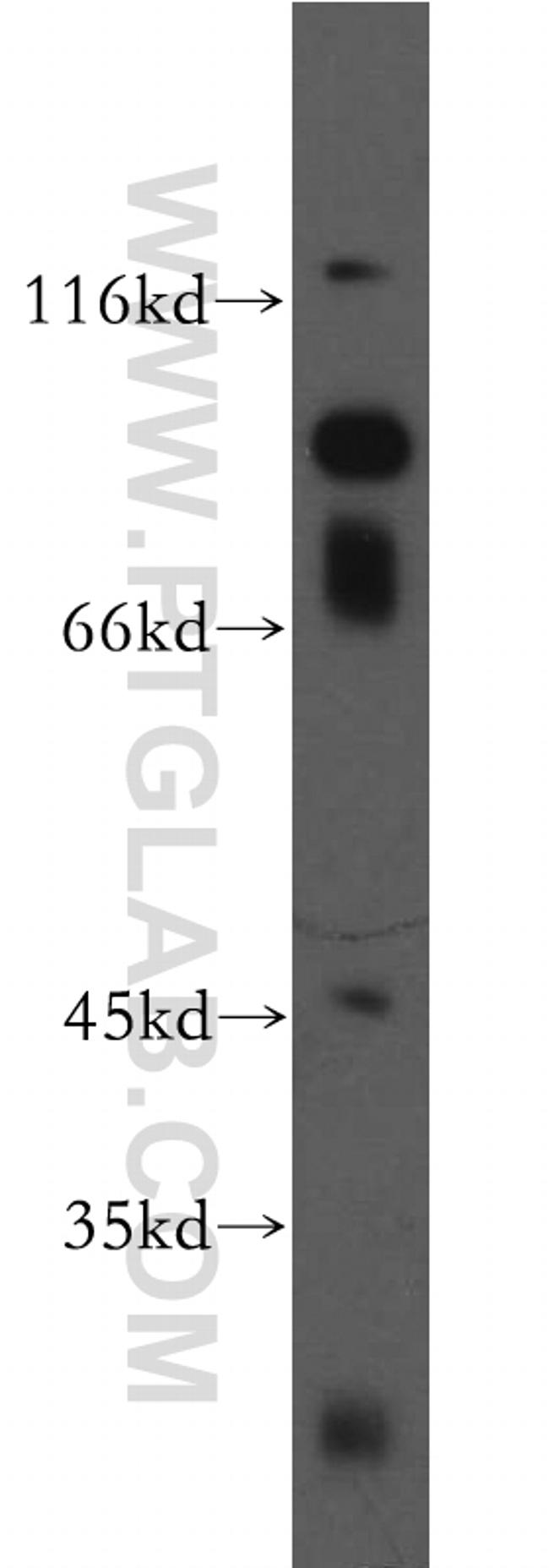 FGFR2 Antibody in Western Blot (WB)