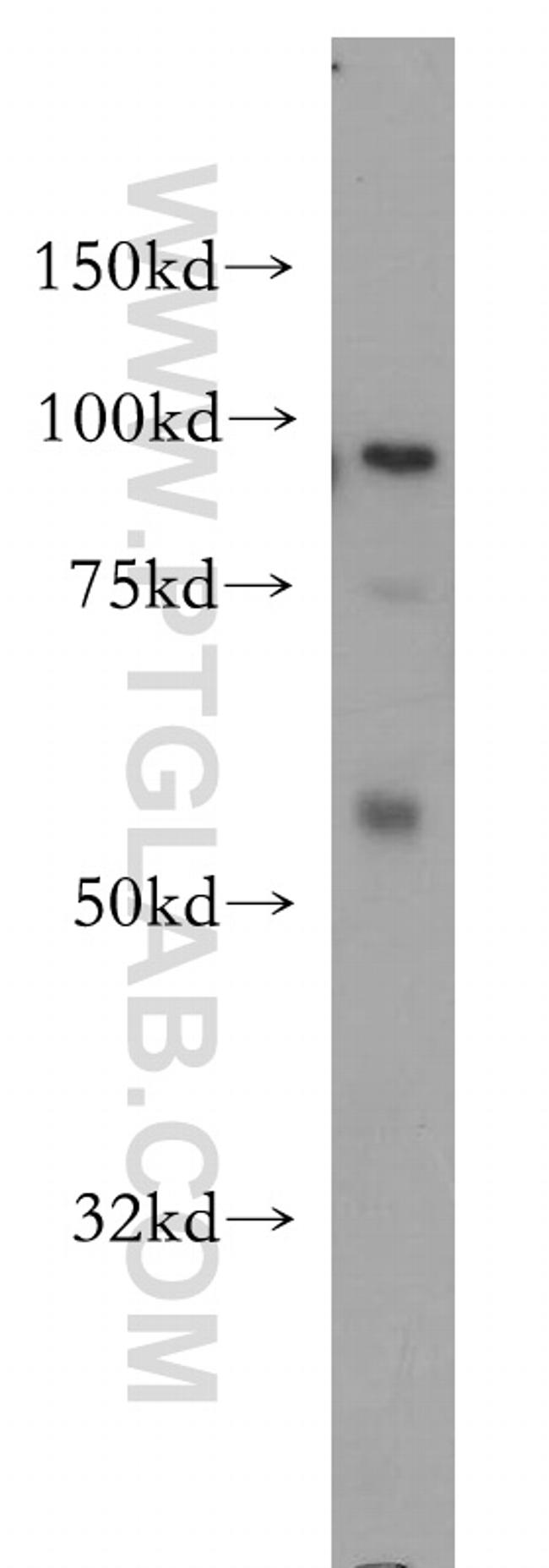 MCM4 Antibody in Western Blot (WB)