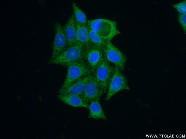 GNS Antibody in Immunocytochemistry (ICC/IF)