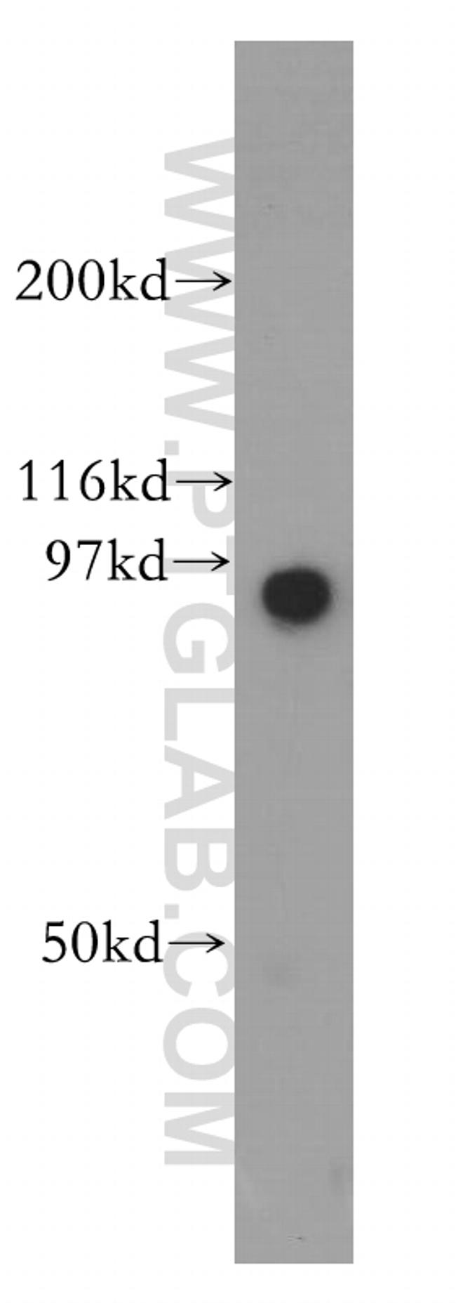 GNS Antibody in Western Blot (WB)