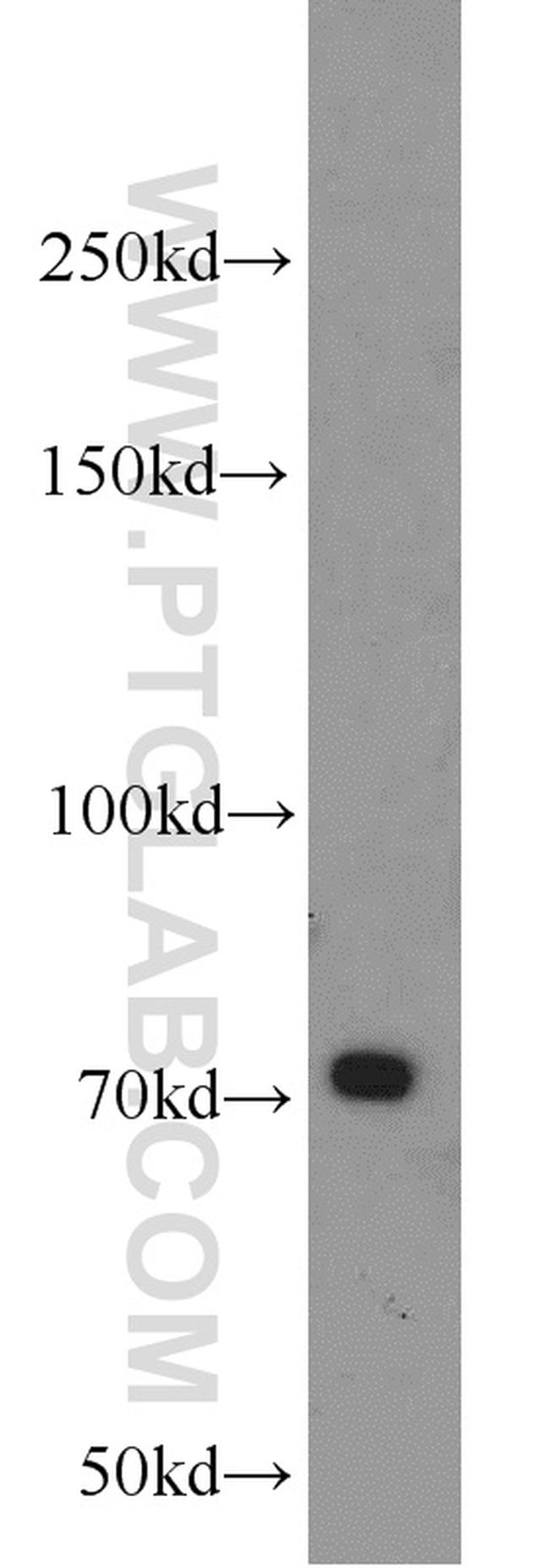 PLEKHA5 Antibody in Western Blot (WB)