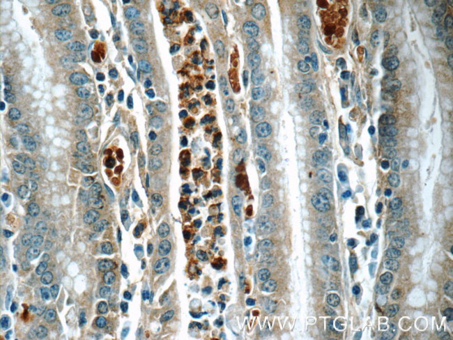 ARL8B Antibody in Immunohistochemistry (Paraffin) (IHC (P))