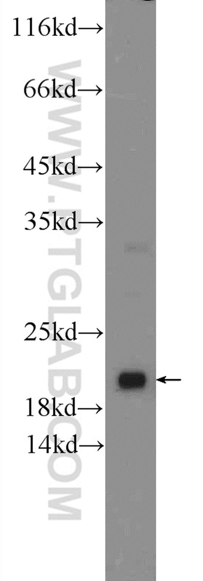 ARL8B Antibody in Western Blot (WB)