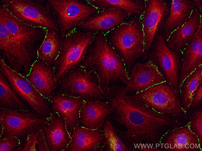 Claudin 1 Antibody in Immunocytochemistry (ICC/IF)